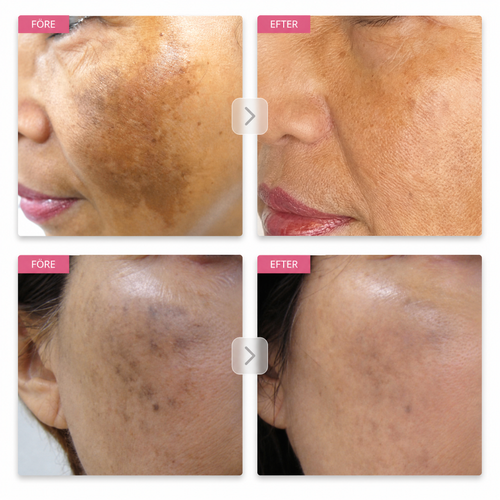 Arbutin 7% Brightening Cream