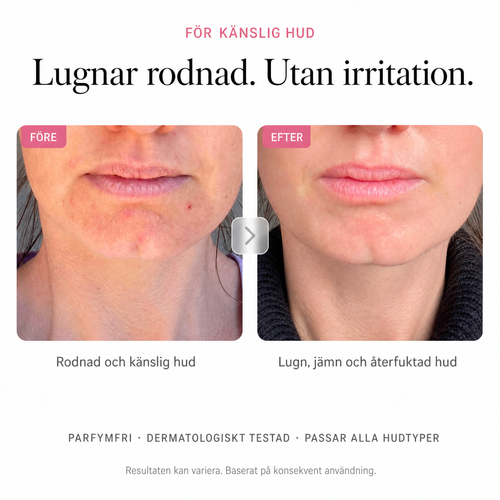 Arbutin 7% Brightening Cream