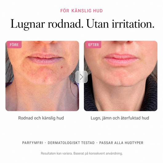 Arbutin 7% Brightening Cream