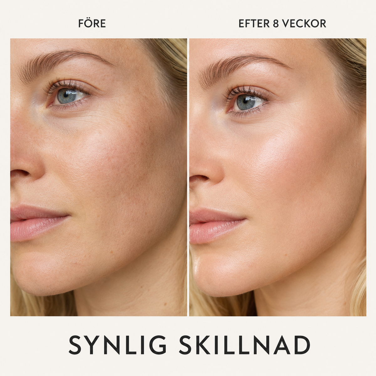 Före och efter åtta veckors användning