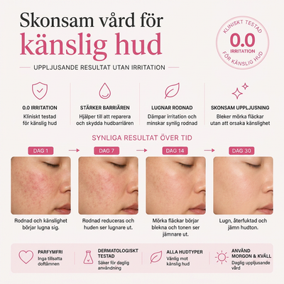 Arbutin 7% + Tranexamic Acid 4% Brightening Cream