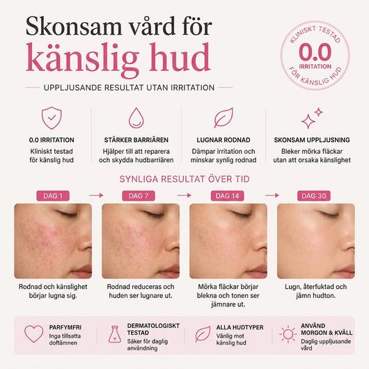Arbutin 7% + Tranexamic Acid 4% Brightening Cream