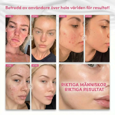 Arbutin 7% + Tranexamic Acid 4% Brightening Cream