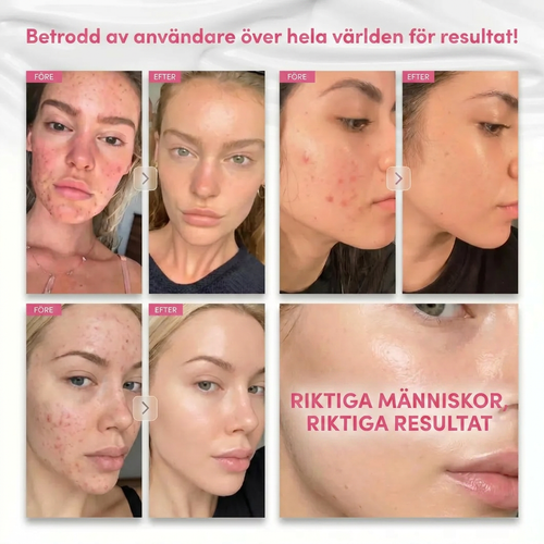Arbutin 7% Brightening Cream