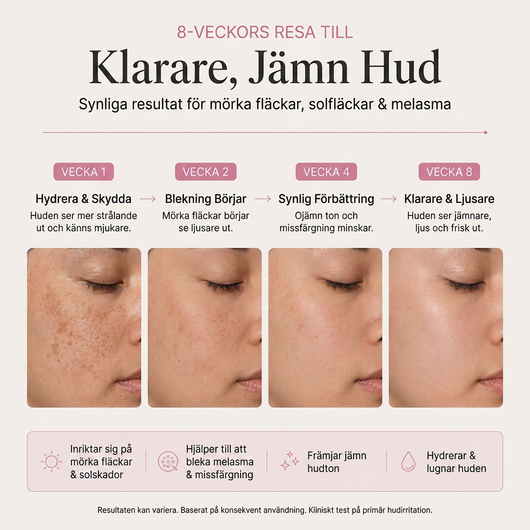 Arbutin 7% + Tranexamic Acid 4% Brightening Cream