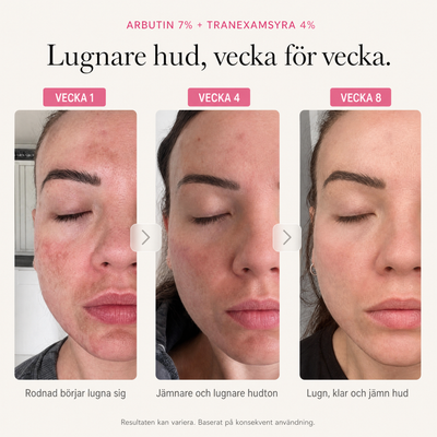 Synliga Resultat Kit, Arbutin 7% Brightening Cream